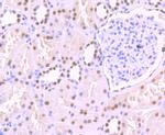 SF3B1 Antibody in Immunohistochemistry (Paraffin) (IHC (P))