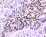 SF3B1 Antibody in Immunohistochemistry (Paraffin) (IHC (P))