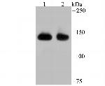 SF3B1 Antibody in Western Blot (WB)