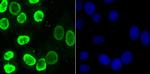 hnRNP U Antibody in Immunocytochemistry (ICC/IF)