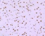 hnRNP U Antibody in Immunohistochemistry (Paraffin) (IHC (P))