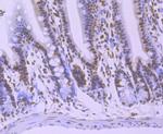 hnRNP U Antibody in Immunohistochemistry (Paraffin) (IHC (P))