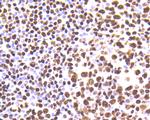 hnRNP U Antibody in Immunohistochemistry (Paraffin) (IHC (P))