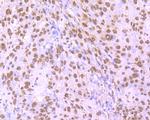 hnRNP U Antibody in Immunohistochemistry (Paraffin) (IHC (P))