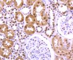 hnRNP U Antibody in Immunohistochemistry (Paraffin) (IHC (P))