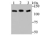 hnRNP U Antibody in Western Blot (WB)