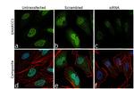 SMARCC1 Antibody in Immunocytochemistry (ICC/IF)