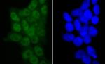 SMARCC1 Antibody in Immunocytochemistry (ICC/IF)