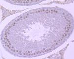 SMARCC1 Antibody in Immunohistochemistry (Paraffin) (IHC (P))