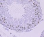 DNA Ligase I Antibody in Immunohistochemistry (Paraffin) (IHC (P))