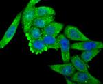 OGT Antibody in Immunocytochemistry (ICC/IF)