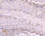 OGT Antibody in Immunohistochemistry (Paraffin) (IHC (P))