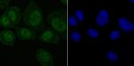 SET Antibody in Immunocytochemistry (ICC/IF)