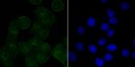 SET Antibody in Immunocytochemistry (ICC/IF)