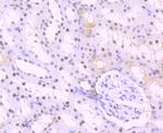 SET Antibody in Immunohistochemistry (Paraffin) (IHC (P))