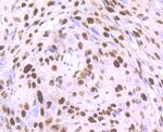 SET Antibody in Immunohistochemistry (Paraffin) (IHC (P))