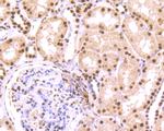 SET Antibody in Immunohistochemistry (Paraffin) (IHC (P))