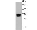 SET Antibody in Western Blot (WB)