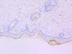 Mast Cell Chymase Antibody in Immunohistochemistry (Paraffin) (IHC (P))