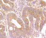 Nesprin 1 Antibody in Immunohistochemistry (Paraffin) (IHC (P))