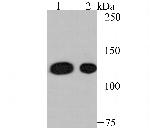 Nesprin 1 Antibody in Western Blot (WB)