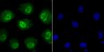 Phospho-alpha Synuclein (Ser129) Antibody in Immunocytochemistry (ICC/IF)