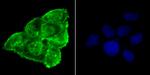 Phospho-alpha Synuclein (Ser129) Antibody in Immunocytochemistry (ICC/IF)