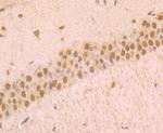 Phospho-alpha Synuclein (Ser129) Antibody in Immunohistochemistry (Paraffin) (IHC (P))