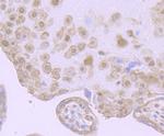 HIF-2 alpha Antibody in Immunohistochemistry (Paraffin) (IHC (P))