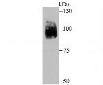 HIF-2 alpha Antibody in Western Blot (WB)