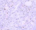 p53 Antibody in Immunohistochemistry (Paraffin) (IHC (P))