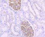 Podocin Antibody in Immunohistochemistry (Paraffin) (IHC (P))