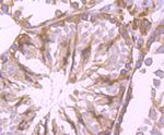 Cytochrome P450 Reductase Antibody in Immunohistochemistry (Paraffin) (IHC (P))