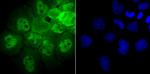 PSMB8 Antibody in Immunocytochemistry (ICC/IF)