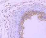 PSMB8 Antibody in Immunohistochemistry (Paraffin) (IHC (P))