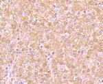 PSMB8 Antibody in Immunohistochemistry (Paraffin) (IHC (P))