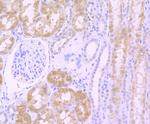 TGF alpha Antibody in Immunohistochemistry (Paraffin) (IHC (P))