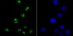 KDM5A Antibody in Immunocytochemistry (ICC/IF)