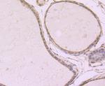 SRC1 Antibody in Immunohistochemistry (Paraffin) (IHC (P))