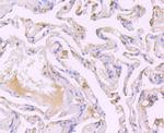 SRC1 Antibody in Immunohistochemistry (Paraffin) (IHC (P))