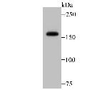 SRC1 Antibody in Western Blot (WB)