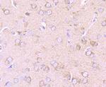 PDK2 Antibody in Immunohistochemistry (Paraffin) (IHC (P))