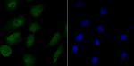 RPA70 Antibody in Immunocytochemistry (ICC/IF)