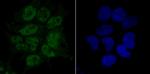 RPA70 Antibody in Immunocytochemistry (ICC/IF)