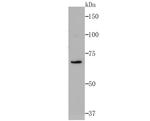 RPA70 Antibody in Western Blot (WB)