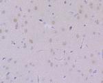 USP7 Antibody in Immunohistochemistry (Paraffin) (IHC (P))