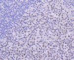 USP7 Antibody in Immunohistochemistry (Paraffin) (IHC (P))