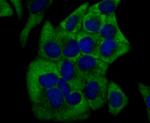 CYP17A1 Antibody in Immunocytochemistry (ICC/IF)