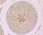 MCM3 Antibody in Immunohistochemistry (Paraffin) (IHC (P))