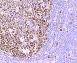 MCM3 Antibody in Immunohistochemistry (Paraffin) (IHC (P))